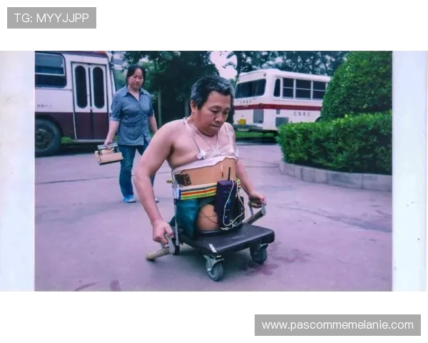 西塞自述命运坎坷仍心怀感恩即使截肢也要以人生为中心